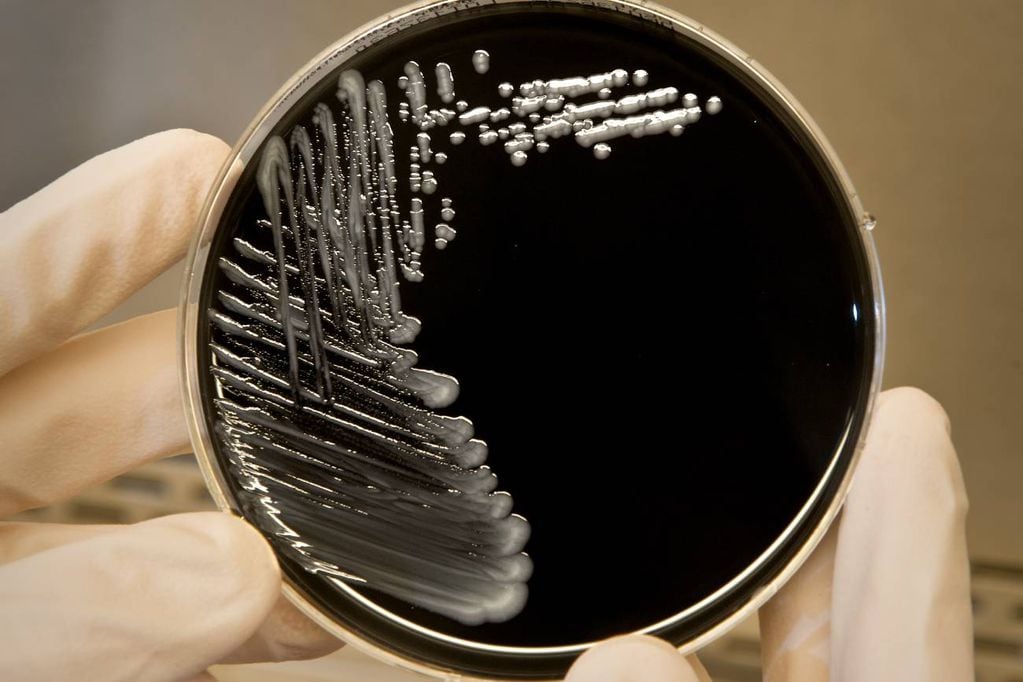 Bacteria. La legionella provoca brotes asociados a una fuente de agua. (CDC)