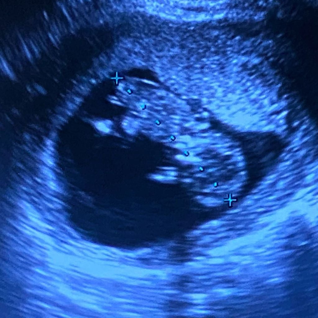 Kelly Osbourne está embarazada y lo anunció en Instagram