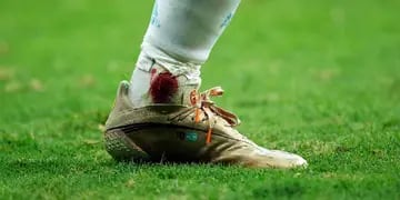 Messi y su tobillo ensangrentado
