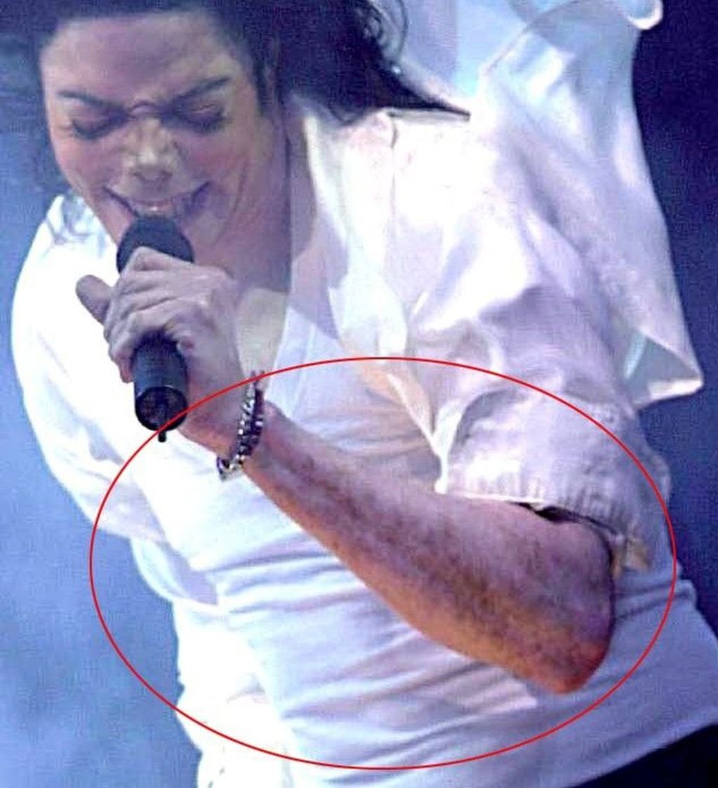 Michael Jackson con vitíligo - Archivo web
