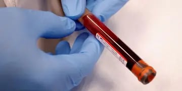  Quienes hayan tenidco coronavirus y han logrado curarse pueden donar voluntariamente el plasma para poder comenzar el ensayo clínico. 