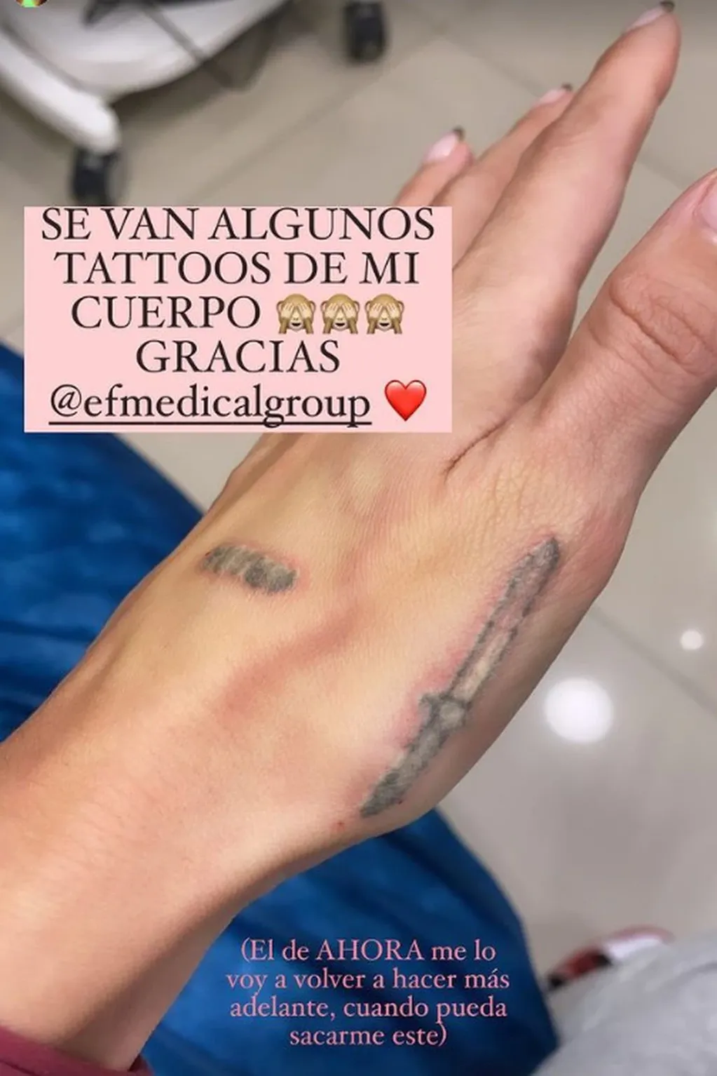 La hija de Marcelo Tinelli adelantó que se sometió a un tratamiento láser para borrarse los tatuajes