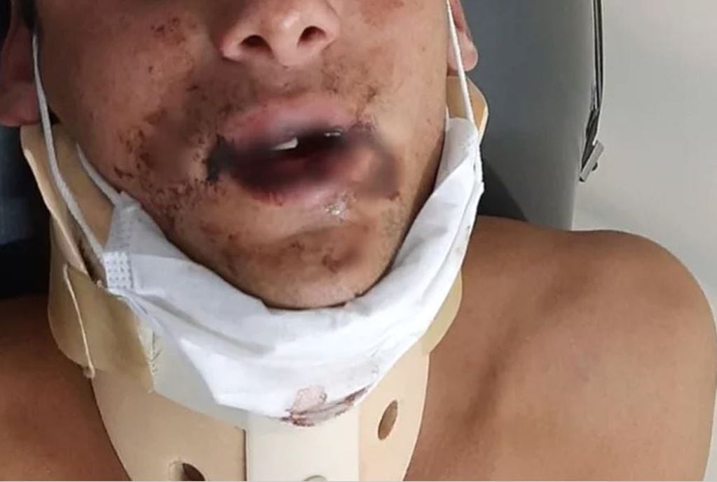 Por la pelea uno de los jóvenes quedó internado en terapia intensiva. Foto: Gentileza.