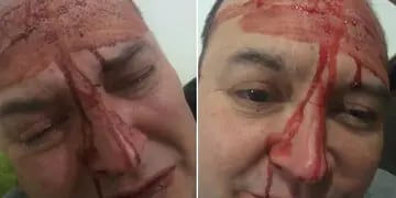Apareció el video de la agresión a Leo García