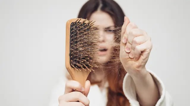 Hair Recovery, caída del cabello,tratamiento Nutrifol
