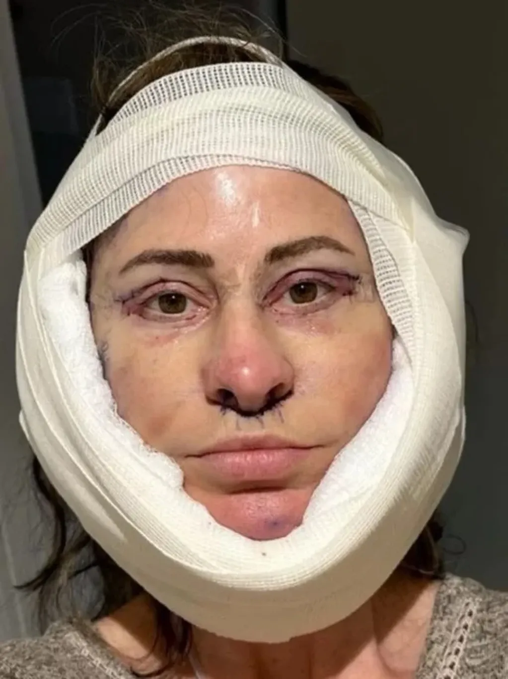 Kelly Beasley durante la operación. Foto: SWNS