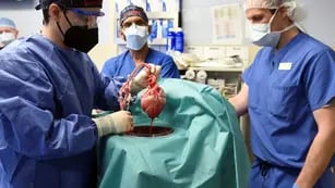 Inédito: trasplantan el corazón de un cerdo modificado genéticamente a una persona