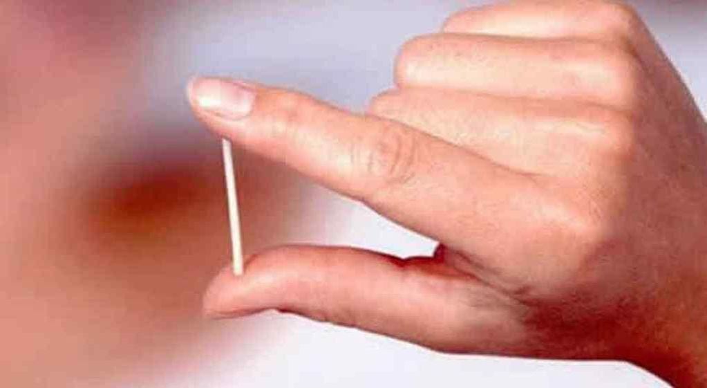 El implante subdérmico, un anticonceptivo que comienza a extenderse y se usa en adolescentes
