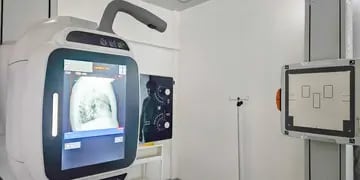 El Hospital Modular de Tolhuin sumó un nuevo equipo de rayos X