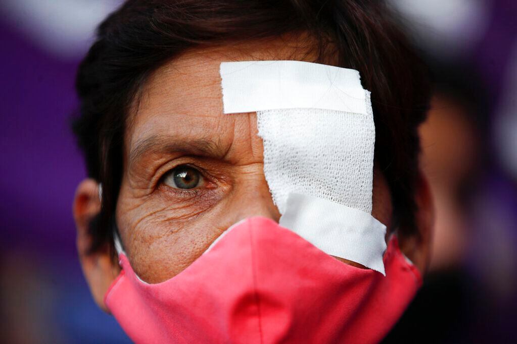 Una mujer, con un ojo tapado, durante una protesta contra la violencia de género en Buenos Aires, Argentina
