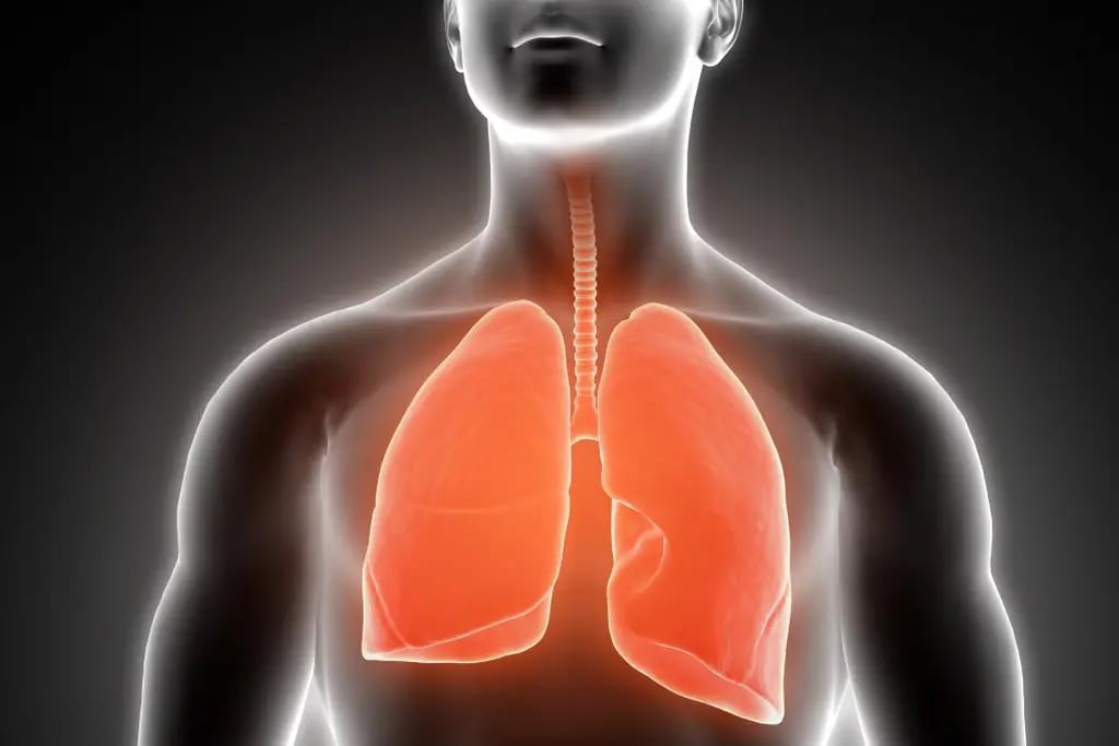 Trasplante pulmonar