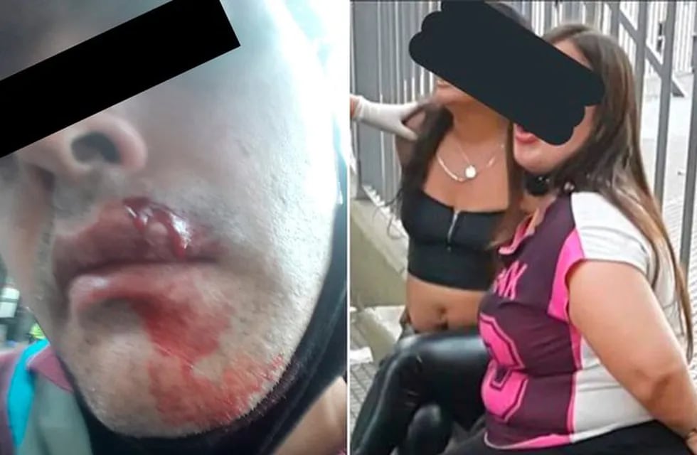 Dos mujeres atacaron con piedras al Policía que les pidió que se colocaran el barbijo.