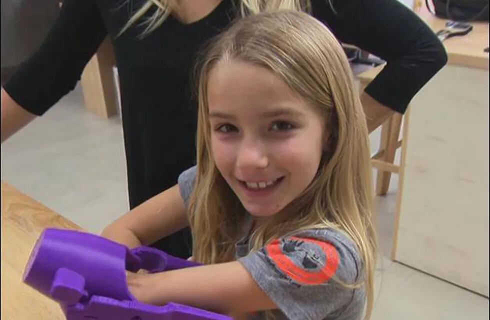 Vida nueva: imprimieron una mano 3D para una nena de 7 años