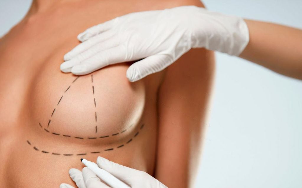 Los implantes mamarios no pueden ser rechazados por el cuerpo, el único inconveniente que se puede producir es una contractura capsular o encapsulamiento. 