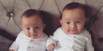 En fotos: las gemelas prematuras que nacieron abrazadas y son inseparables