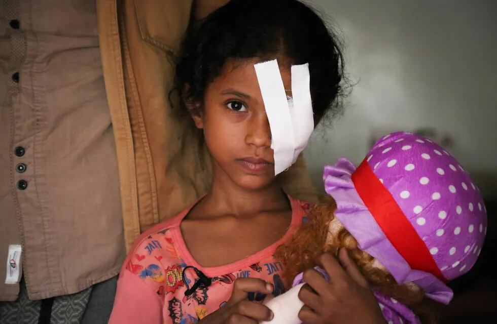Niña mutilada en Yemén
