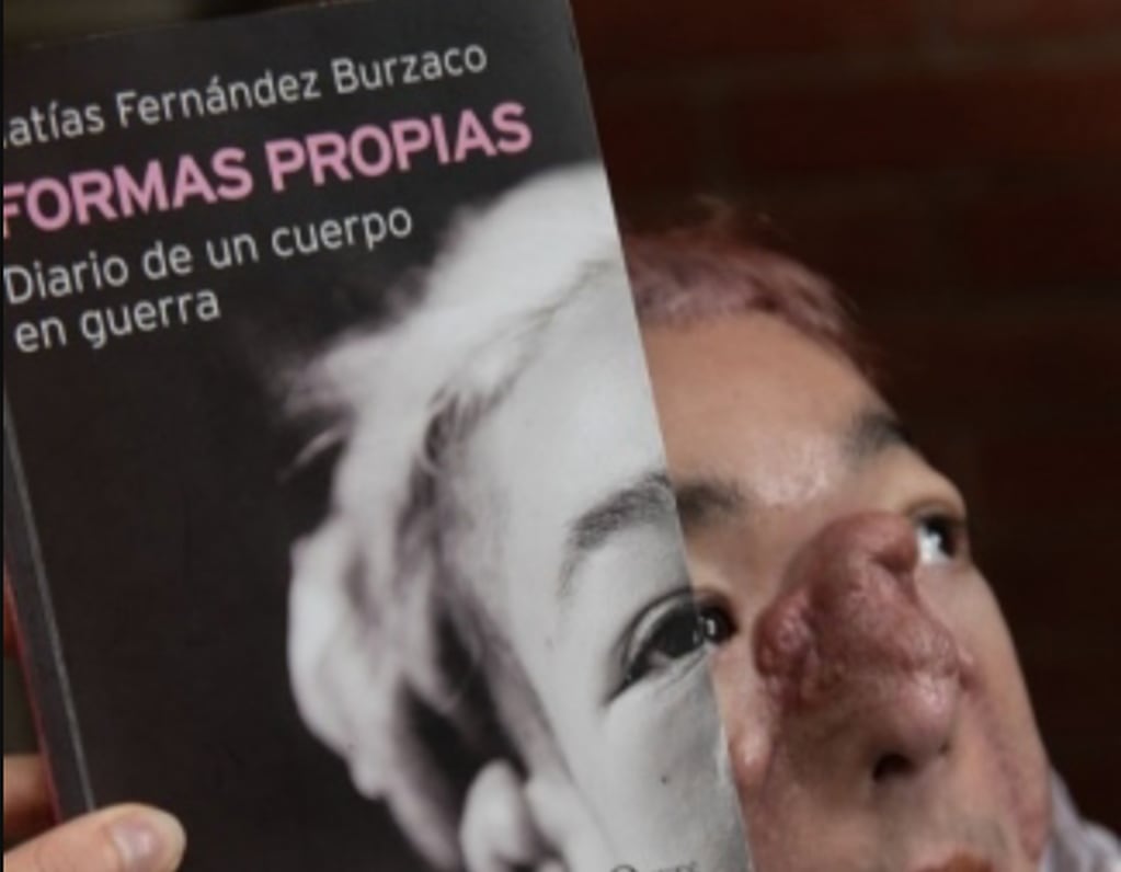Matías Fernández Burzaco presenta su libro Formas Propias, diario de un cuerpo en guerra.