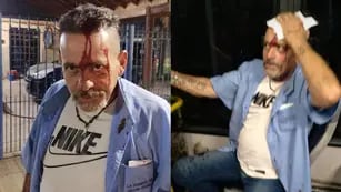 Nuevo ataque a colectivero en Buenos Aires: lo golpearon a culatazos y lo gatillaron tres veces