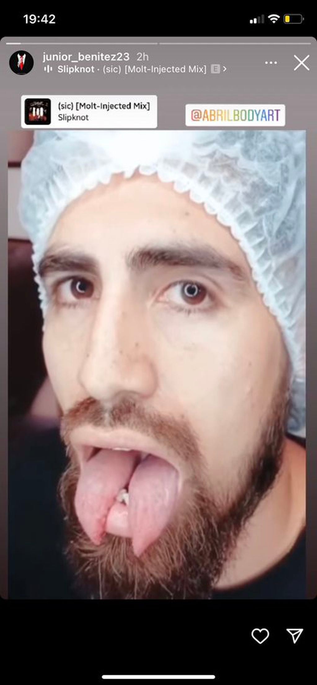 Junior Benítez compartió su foto recién salido de la cirugía donde transformó su lengua para que quede bífida.