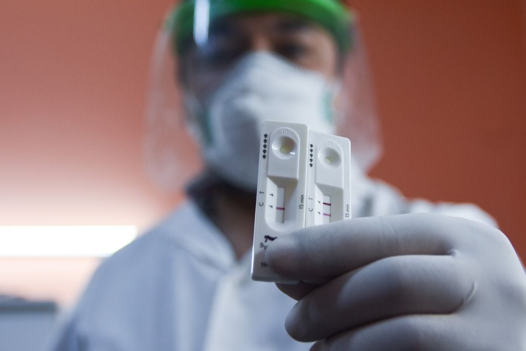 Laboratorios particulares ya realizan los nuevos testeos rápidos por hisopado para detectar antígenos para Covid 19. Foto: Mariana Villa
