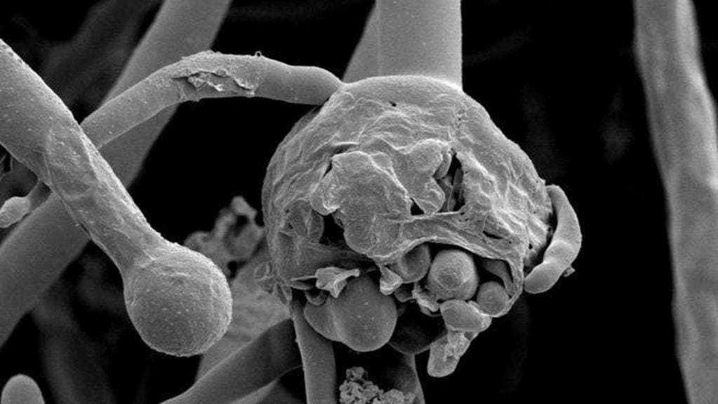 Imagen al microscopio de una infección de mucormicosis.