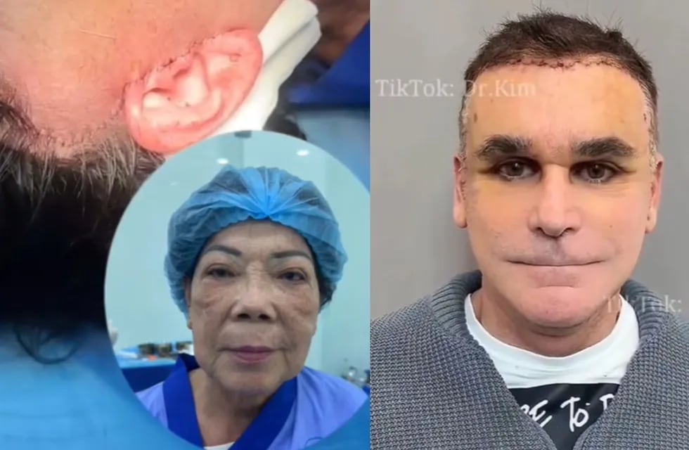 Se trata de un "cirujano" que comparte sus resultados en TikTok