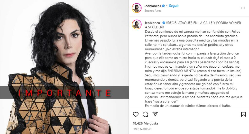 El imitador de Michael Jackson argentino asegura que lo atacan al confundirlo con Felipe Pettinato.