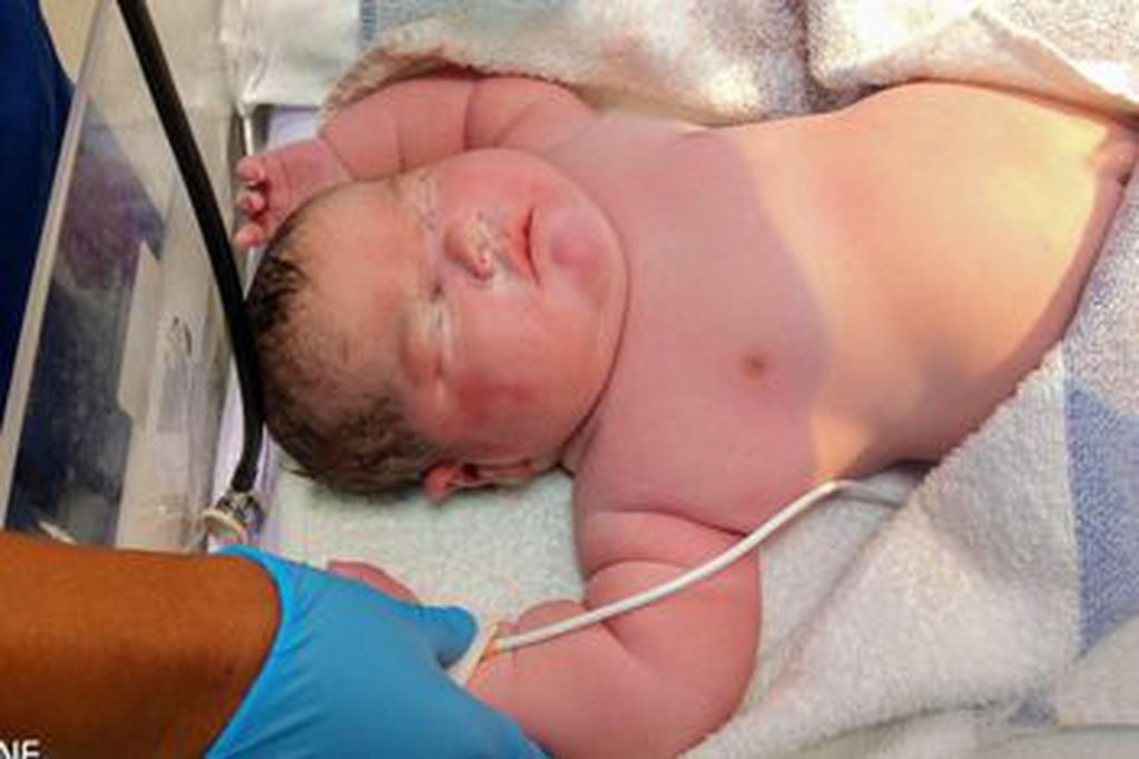 El bebé, que fue nombrado como Alpha, pesó exactamente 6 kilos y 700 gramos. / Gentileza