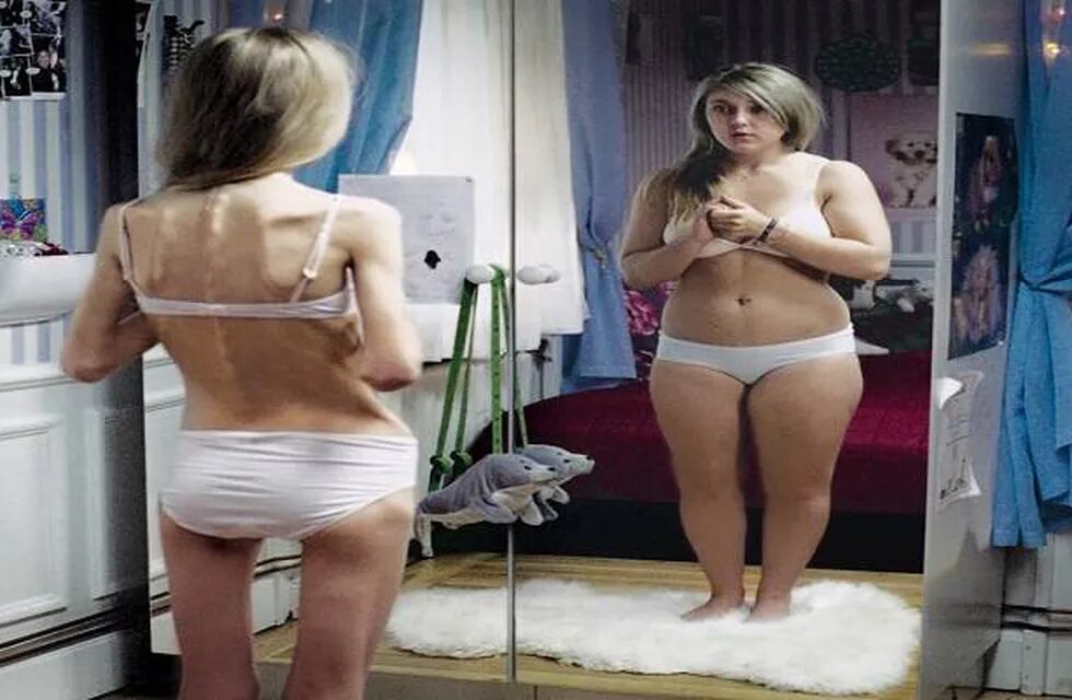 Cómo detectar la anorexia