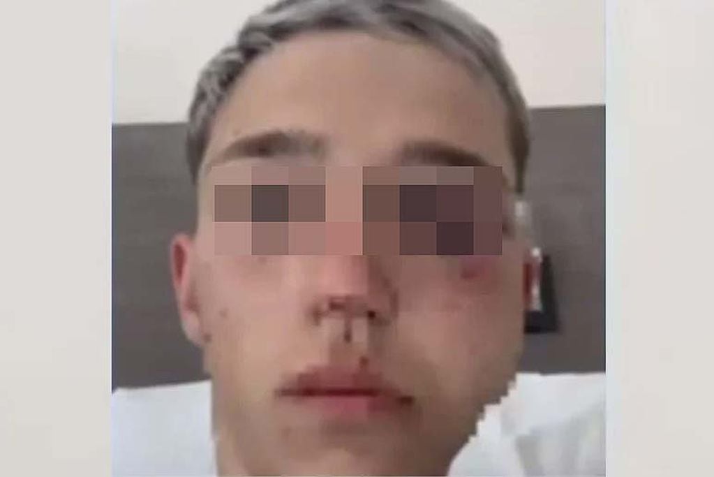 Luján de Cuyo. El chico de 16 años atacado.