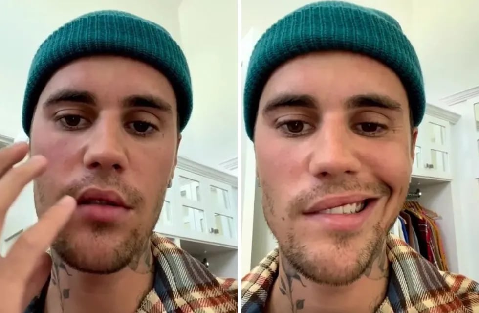 Justin Bieber sufre parálisis facial (Captura de video)