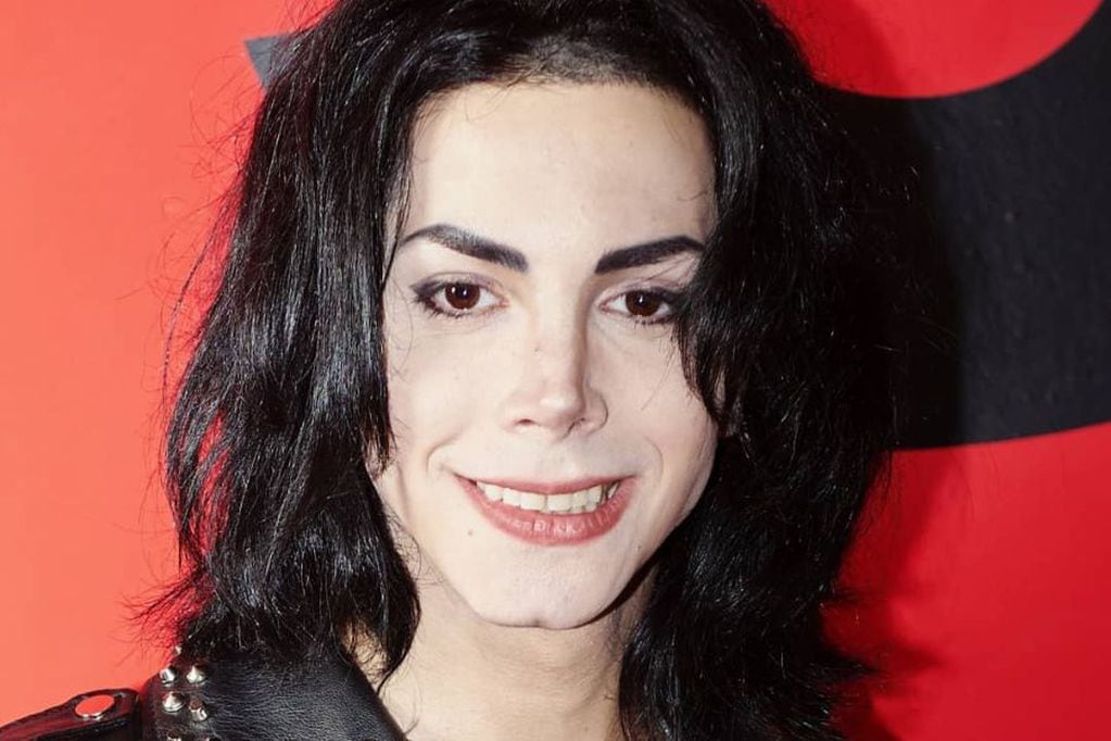 El imitador de Michael Jackson argentino asegura que lo atacan al confundirlo con Felipe Pettinato.