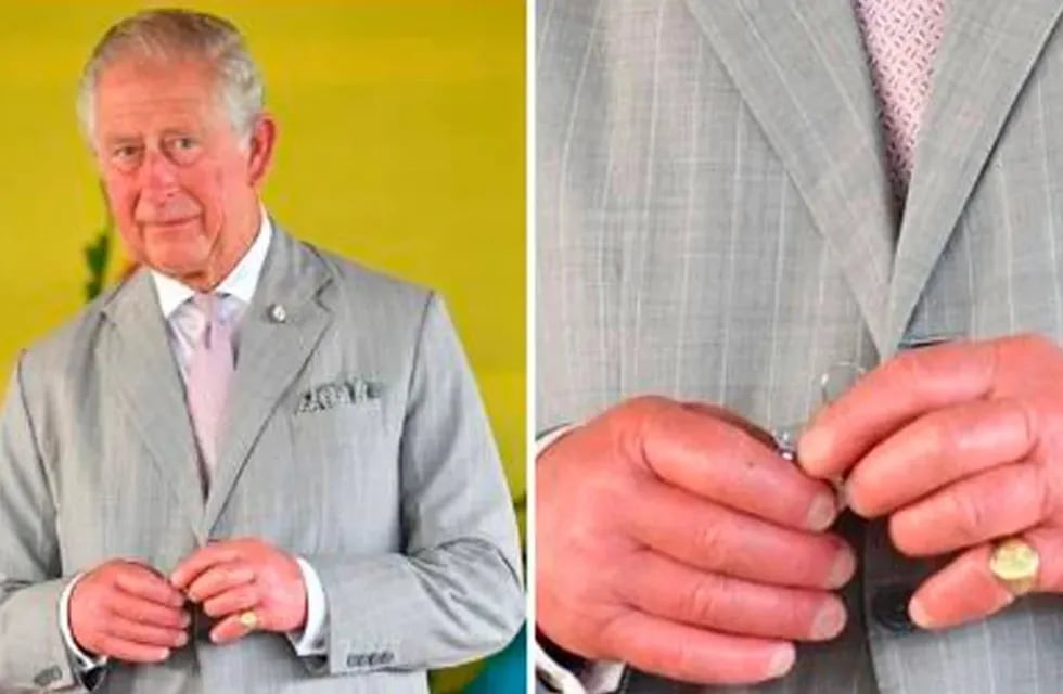 El aspecto de las manos de Carlos III ha llamado la atención y ha abierto sospechas acerca de su estado de salud.