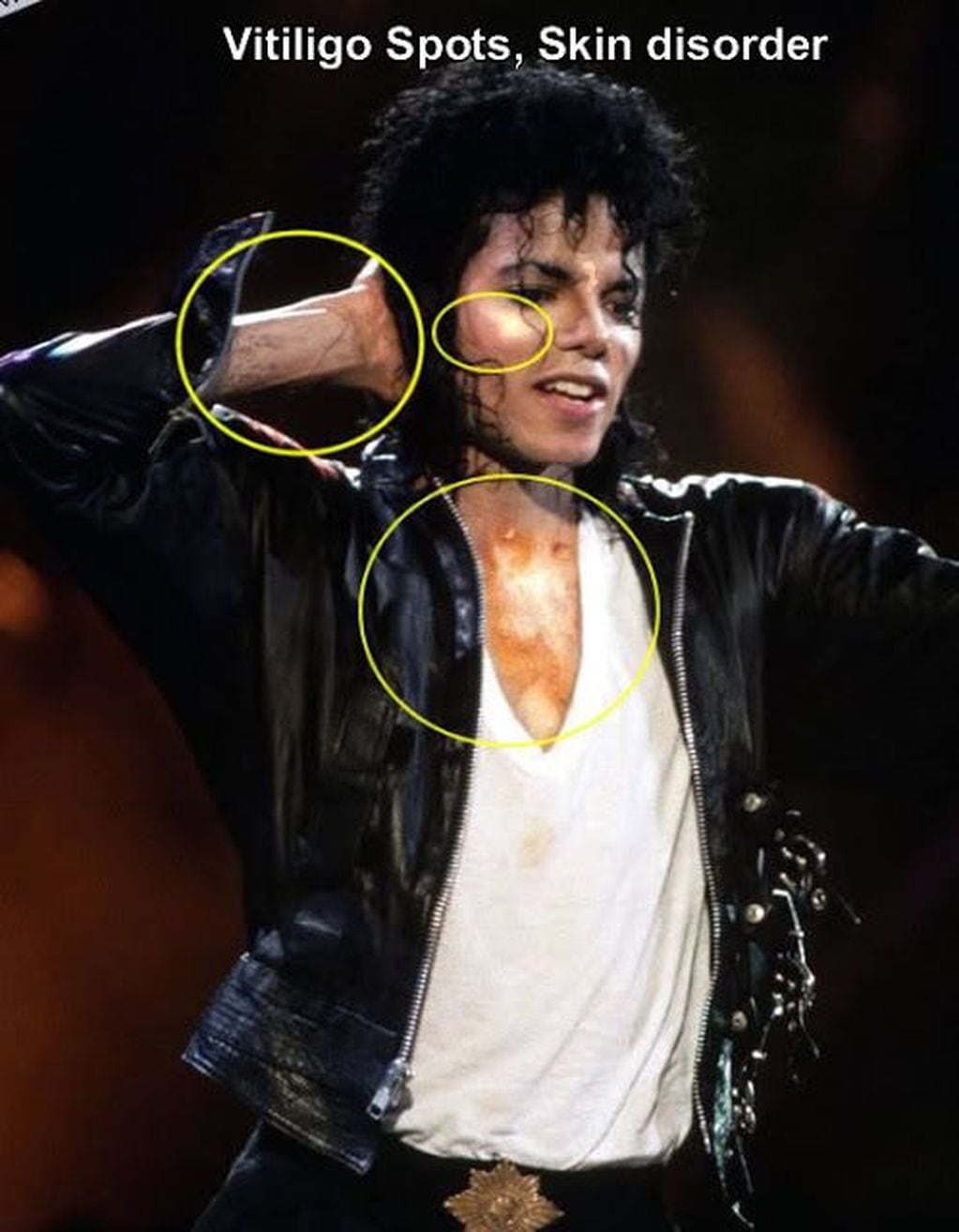 Michael Jackson usaba abundante maquillaje para camuflar la enfermedad - Archivo web