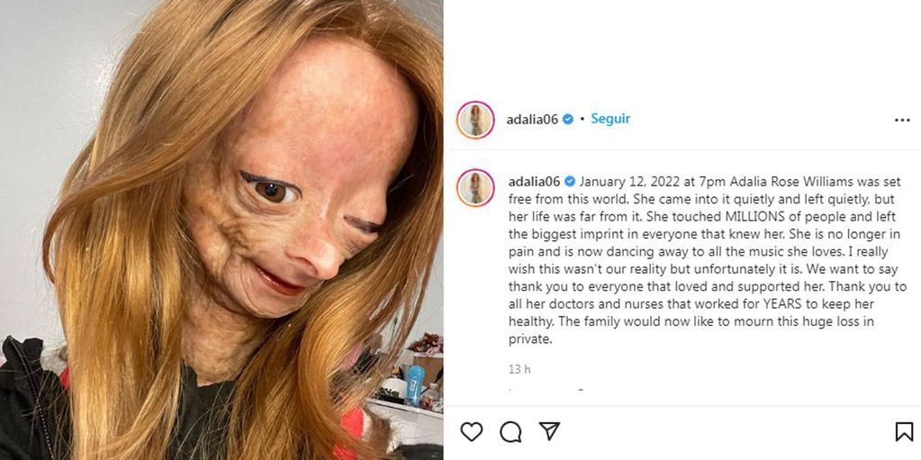 La noticia del fallecimiento de la niña fue dada a conocer por su madre en Instagram.