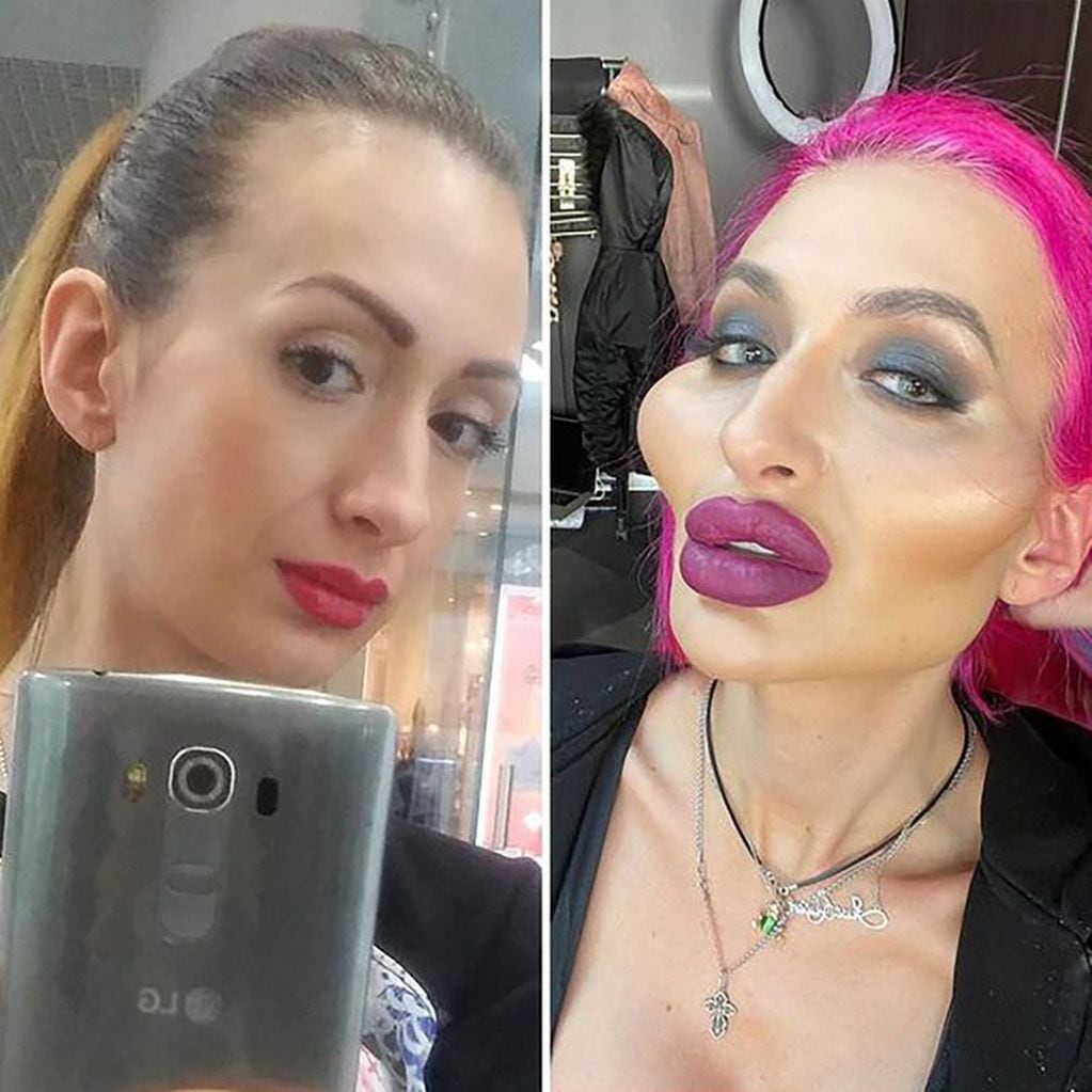 Anastasia Pokreshchuk les preguntó a sus seguidores si preferían su versión actual o cuando tenía 26 años sin cirugías. Foto: Instagram.
