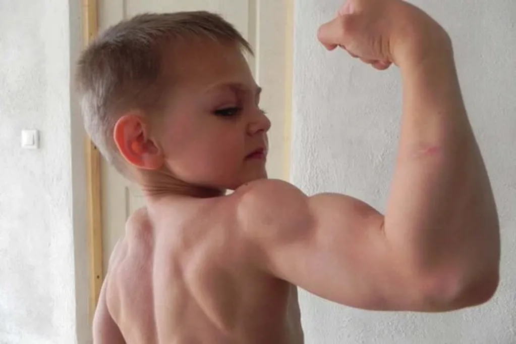 Así luce actualmente Giuliano Stroe, el niño más musculoso del mundo
