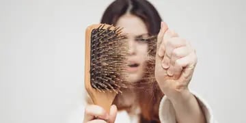Hair Recovery, caída del cabello,tratamiento Nutrifol
