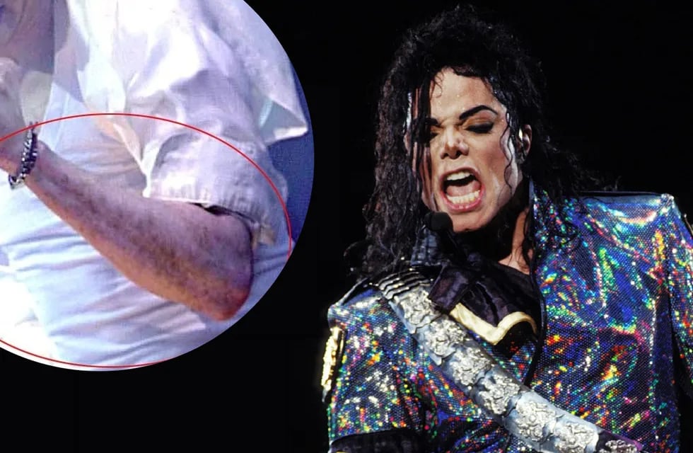 Michael Jackson padecía vitíligo, un desorden en la piel (Archivo)