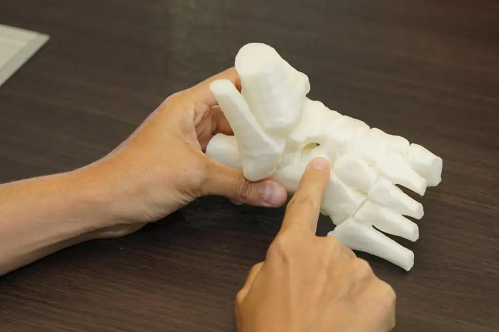 Junín prótesis impresoras 3D
