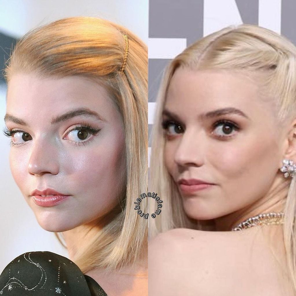 El antes y después de Anya Taylor-Joy