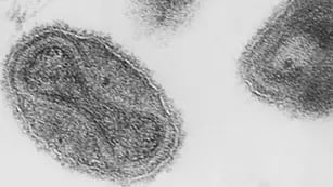 Se han reportado en Inglaterra siete casos de una extraña viruela