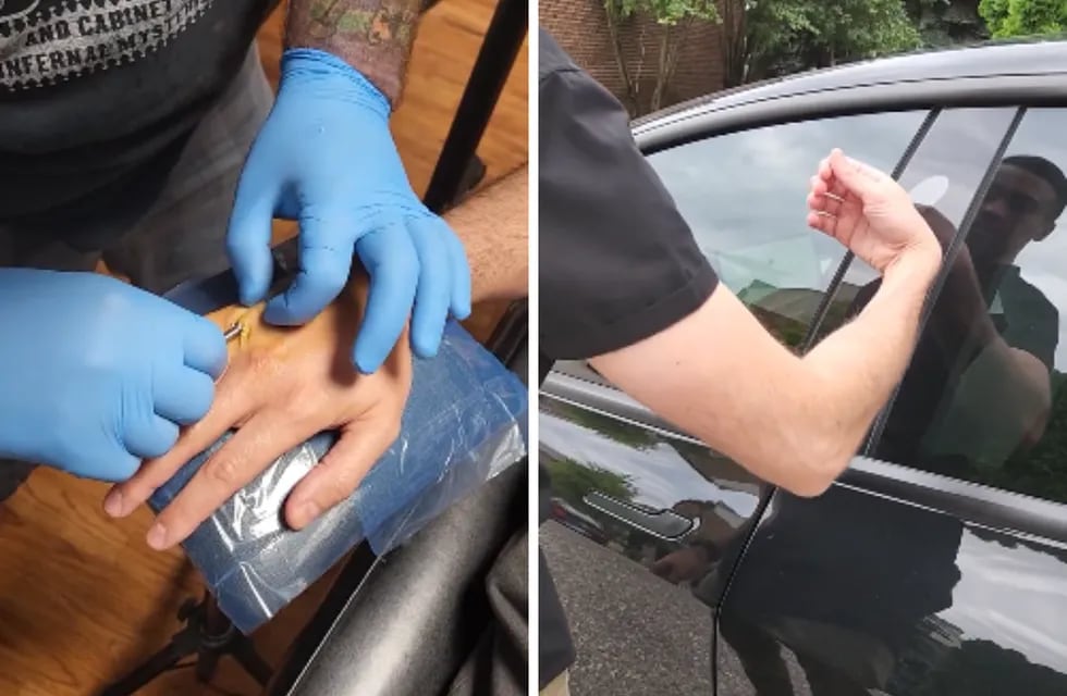 Un hombre se implantó las llaves de su Tesla en la mano.