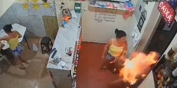 Río de Janeiro: Incendió a su pareja por celos