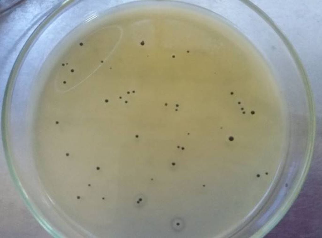 Staphylococcus aureus colonia