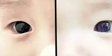 Ojos de bebé cambian de color