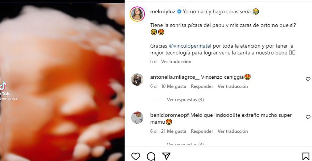 Melody Luz mostró la carita de su bebé