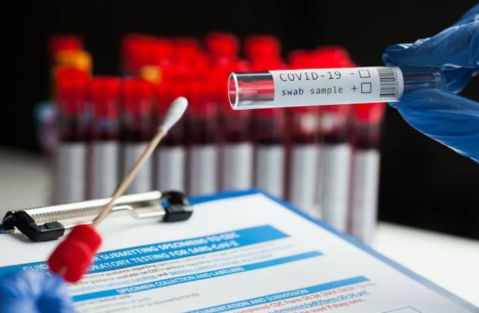 Bioquímicos piden realizarse test en lugares autorizados y supervisados por profesionales.