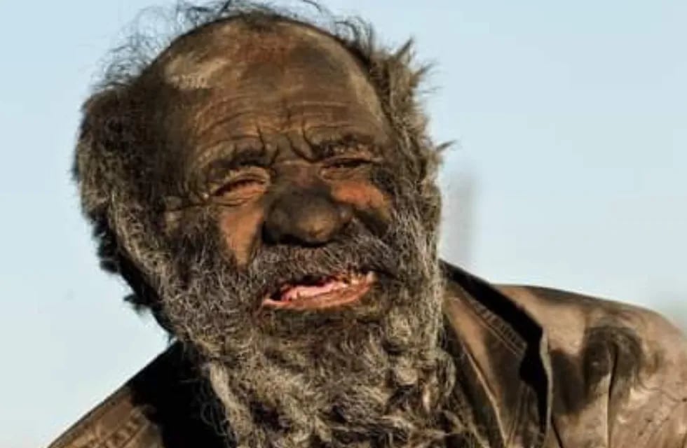 Murió el “Hombre más Sucio del Mundo” a sus 94 años: no se bañó en medio siglo. / Foto: Gentileza