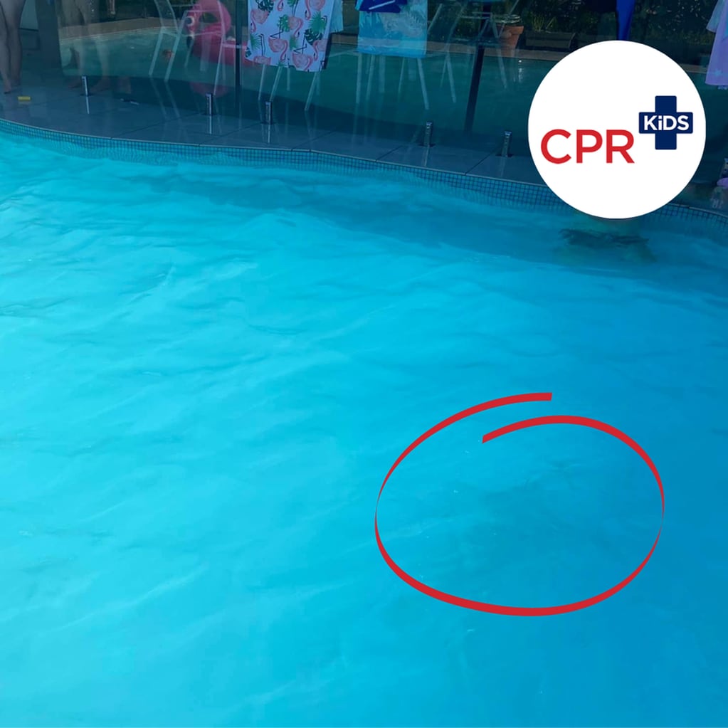 La mancha corresponde a un niño con un traje de baño azul, nadando en el fondo de la pileta. Foto: Gentileza